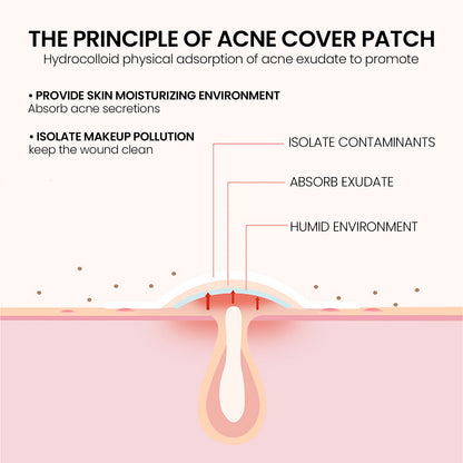 Pimple Patches,Pimple Patches For Face, Hydrocolloid Acne Patches, Cute Star Stickers Hydrocolloid Acne Pimple Patch For Covering Zits And Blemishes